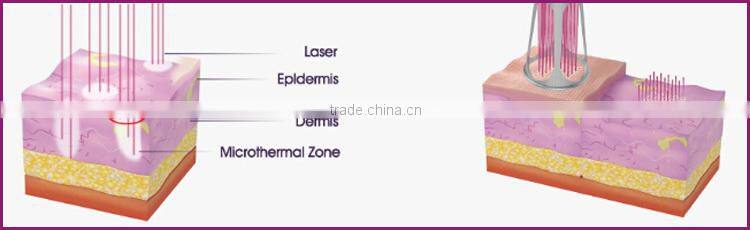 New arrival beauty machine vaginal tightening best rf fractional co2 laser