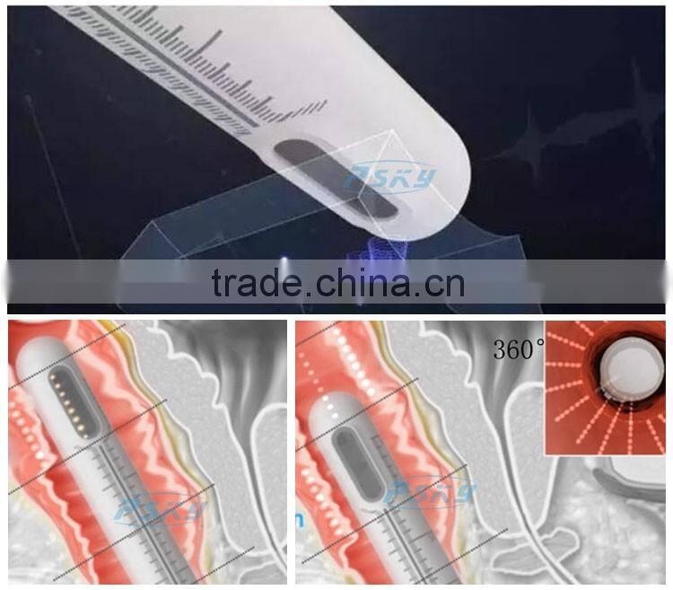 10000 shots woman painless vaginal rejuvenation HIFU machine for sale