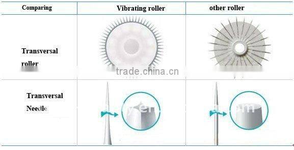 2012 Most Popular Mini beauty Device!! dts 540 titanium micro needle roller L007