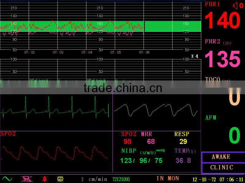 Fetal Monitor,CE approved