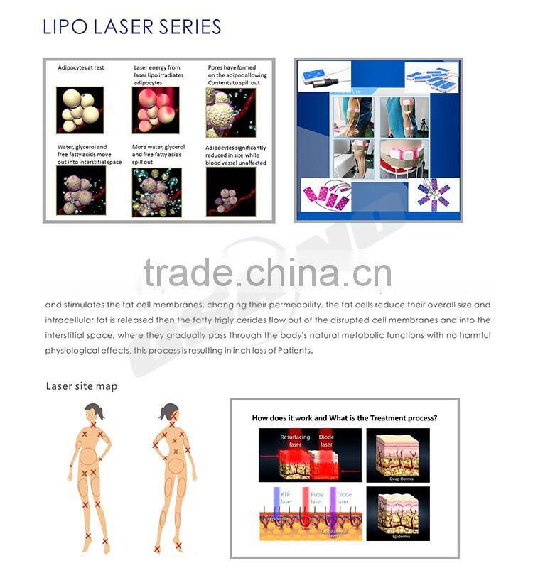 Portable Home Use Cold Laser Weight Loss Machine Aesthetic