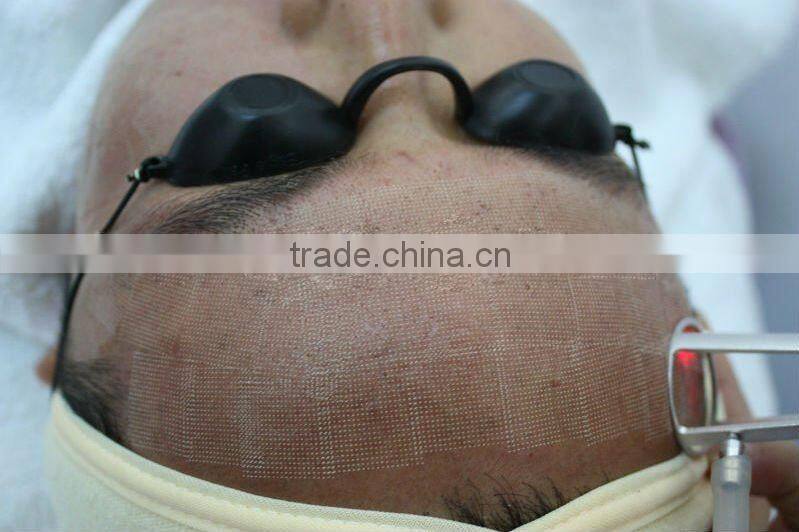 professional co2 laser RF tube price for scar removal and skin resurfacing laser