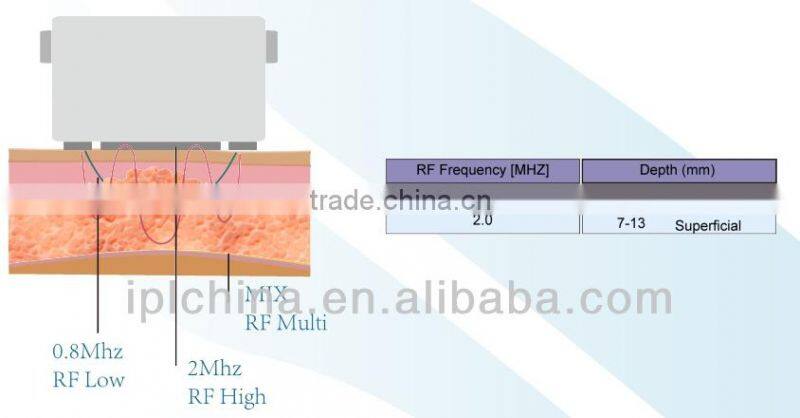 2014 Ultrasound Skin Rejuvenation Skin Analysis Machine -IBelle 2