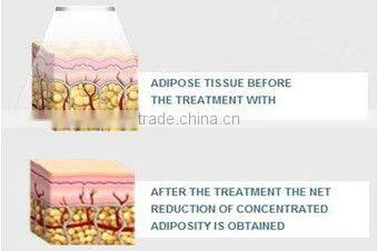 Cavitation RF Ultrasonic Vacuum Machine S80C ISO/CE Liposlim Cavitation Machine