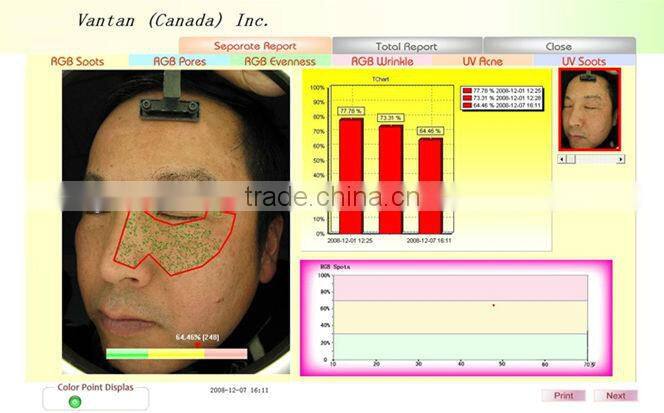 China Best Selling Bauty Machine: high performance mini skin analyzer handheld skin analyzer with CE