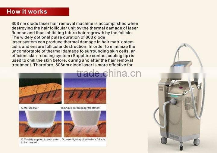 New 808 nm diode laser SHR rapid hair removal machine