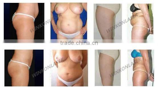 body slimming shapewear / oem slimming product / body slimming system