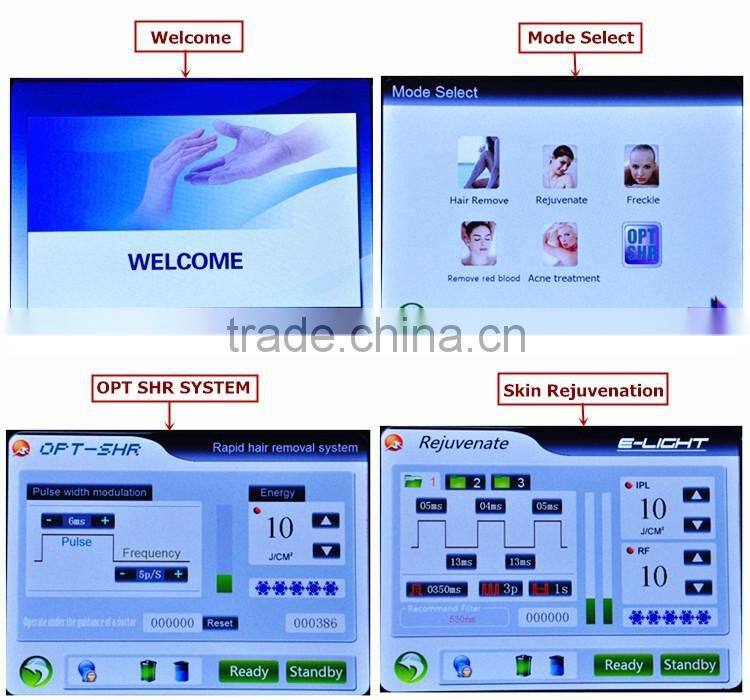 professional ipl hair removal machine/opt shr/hair removal ipl