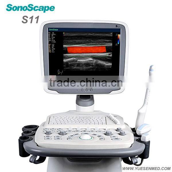 Mobile color Doppler system 3D 4D S11 Sonoscape echography