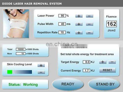 Professional 808nm diode laser hair removal machine