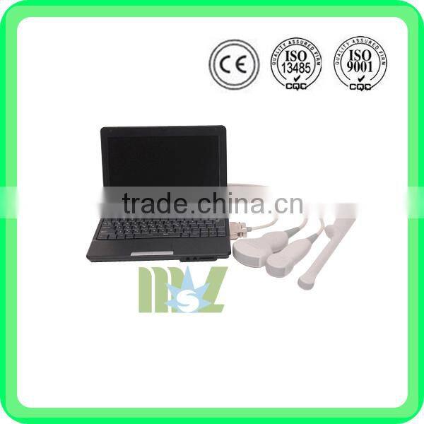 (Pregnant week,fetal weight,volume.etc) Both use in human and animal new portable laptop ultrasound machine/scanner/system price