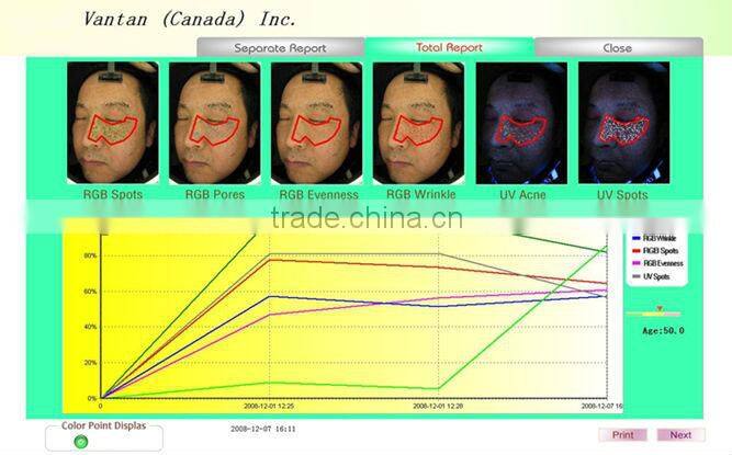 China Best Selling Bauty Machine: high performance mini skin analyzer handheld skin analyzer with CE