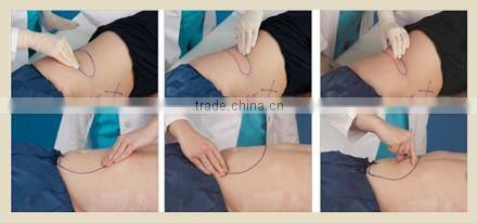 2016 Most advanced High Intensity Focused ultrasound HIFU body slimming lipo hifu machine/ HIFU slimming machine