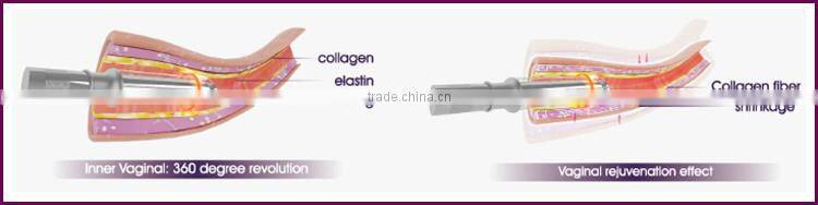Alibaba express 3 in 1 multifunctional co2 laser rf generator