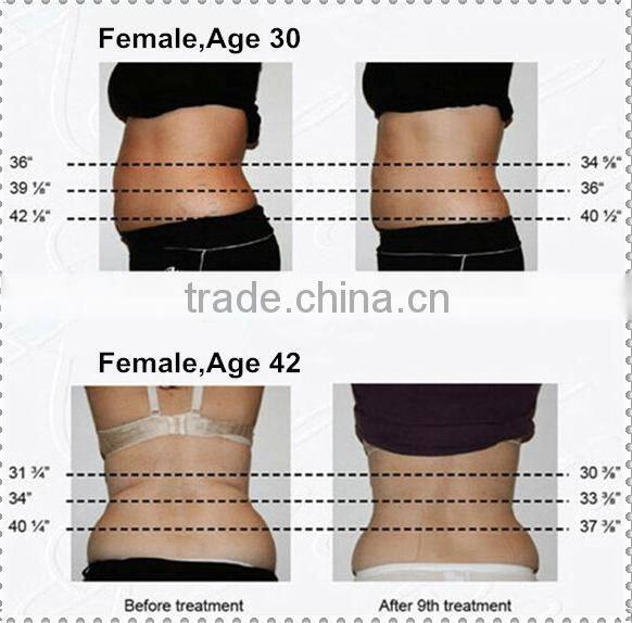 2016 Beauty Slimming Machine RF Fat Machine Weight Loss Machine