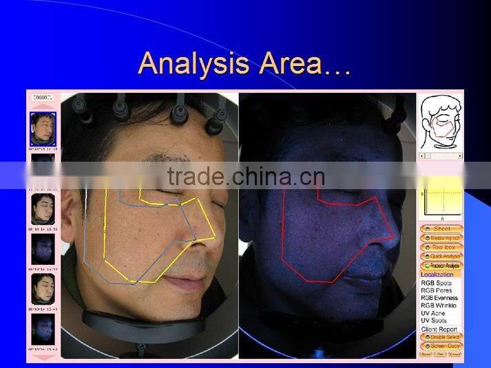 Magic Mirror System Facial Skin Scanner Machine Scan