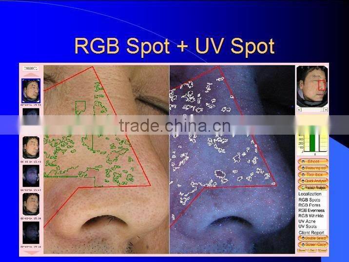 Magic Mirror System Facial Skin Scanner Machine Scan