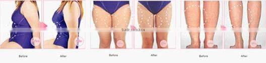 2011 popular Ultrasonic liposuction RF cavitation machine for body slimming F006