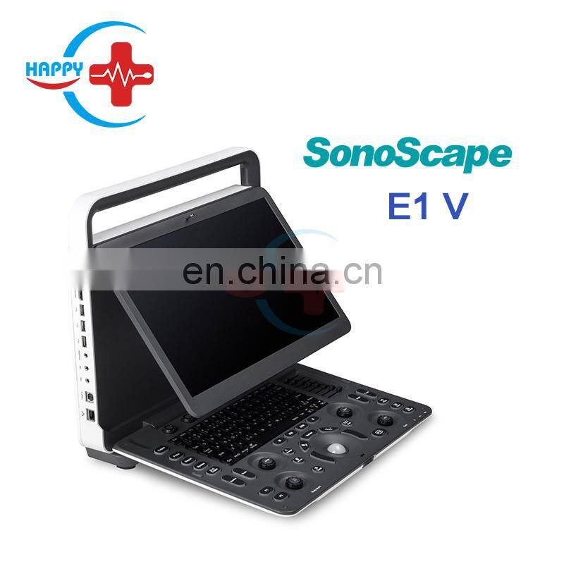 Multifunctional Portable ultrasound probe/Sonoscape E1 vet/Ultrasound machine portable