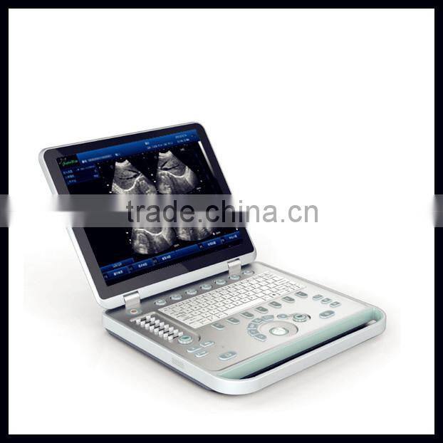 (Pregnant week,fetal weight,volume.etc) Both use in human and animal new portable laptop ultrasound machine/scanner/system price