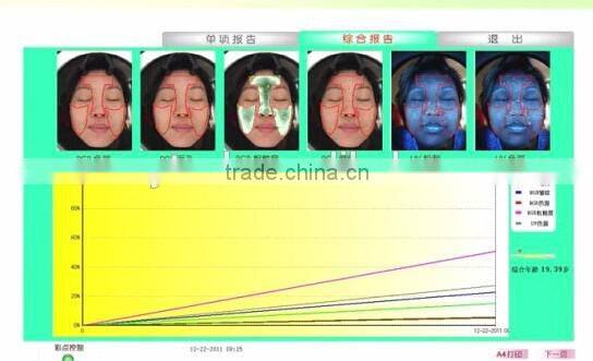 Professional high definition 3d skin analyzer machine / skin scanner analyzer / skin analyzer magnifier machine A10