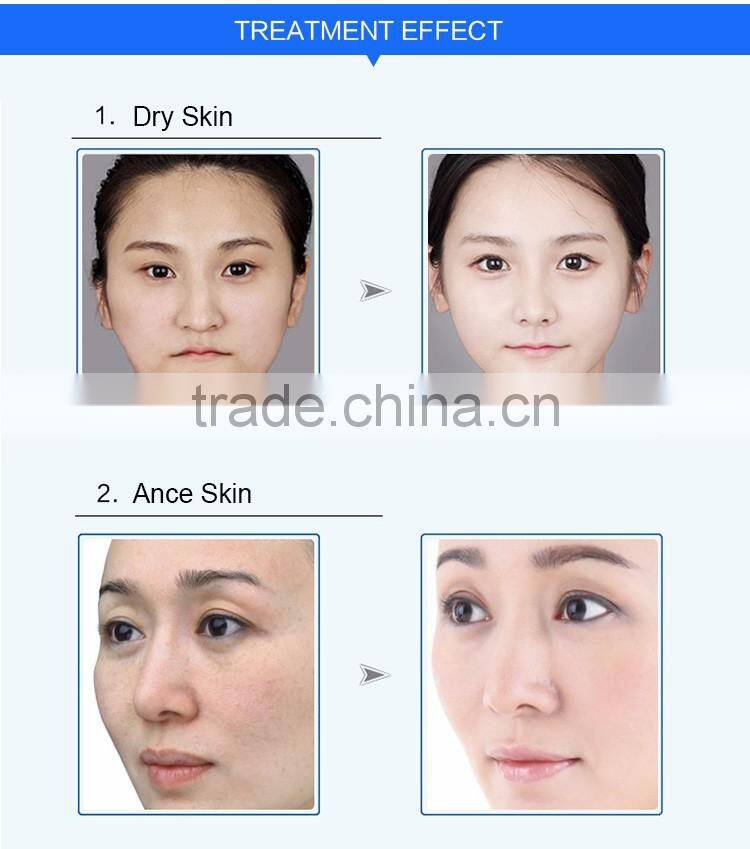 No needle mesotherapy machines skin whitening injection facial massager machine