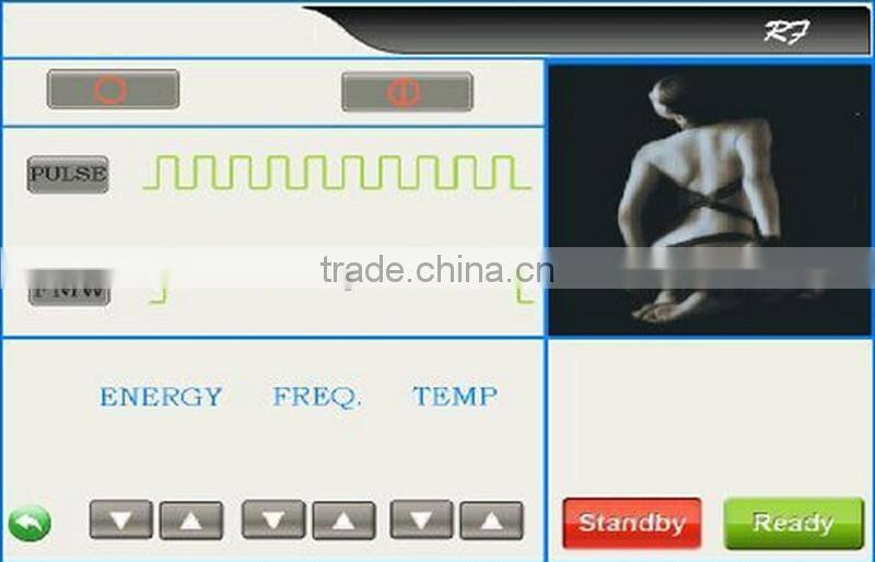 Hot Sale!IPL+Elight+RF 3 in one permenent hair removal machine with CE approved / IPL+Elight+RF Laser machine