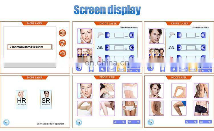 2020 popular maquina de depilacion laser diodo 810 nm machine