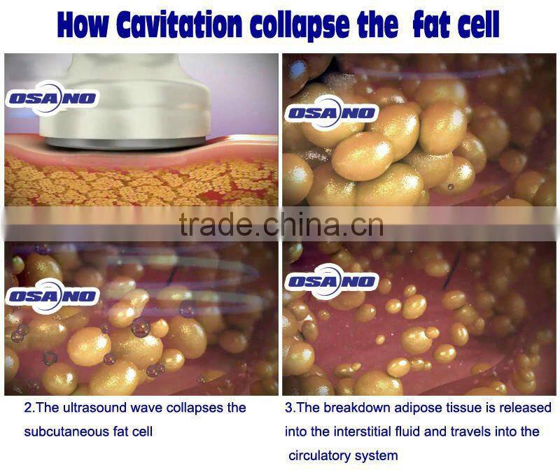 50MHz Ultrasonic vacuum Cavitation multipolar RF body crunch/Slimming equipment/machinery