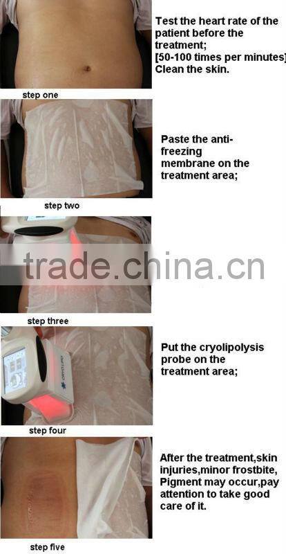 Osano cryolipolysis slimming machine, china new innovative product