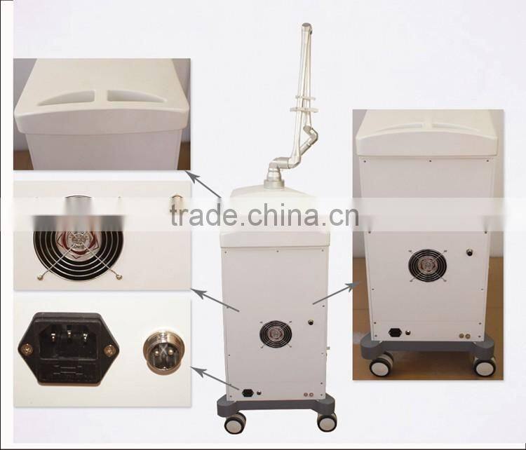 nd yag laser hair removal