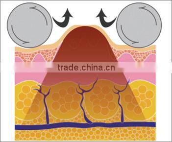 Whole sale weight loss belt for distrubutor