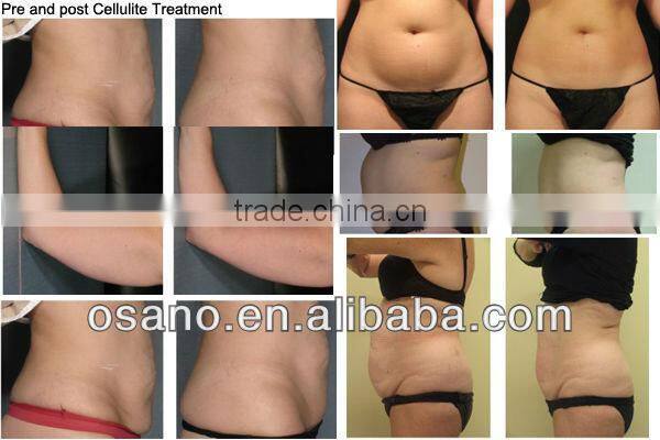 High Quality Good Treatment Effect 3 In 1 Radionics Machine