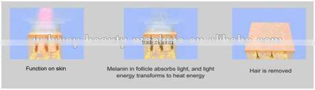 Manufacturer supply 3 handles IPL machine for hair removal skin rejuvenation veins removal