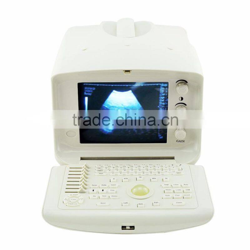 CE Approved One-stop shopping full digital ultrasound scanner price