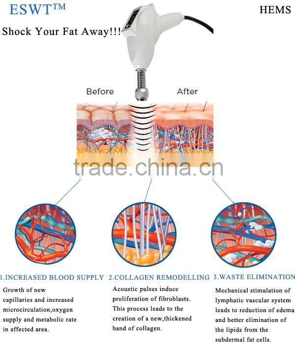 2014 Popular AWT Medical Beauty Equipment For Slimming Body - (ESWT-60)