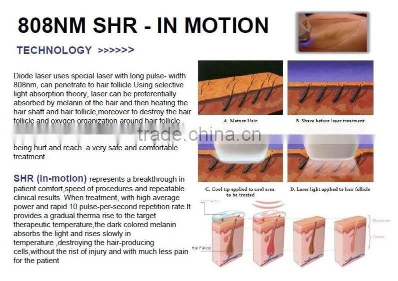Ce approved and cryo cooling system professional laser hair removal machine pain free