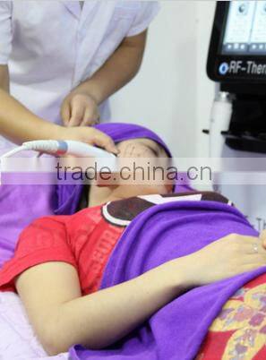 Hot sale portable home-use RF 9D Thermacool Skin Resurfacing and RF Thermacool effectively machine