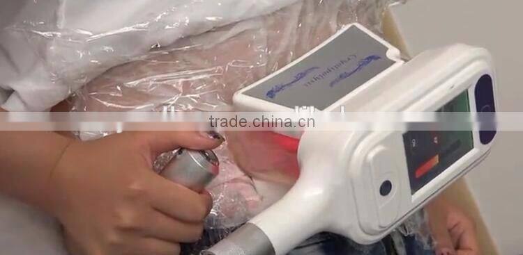 Advanced Vacuum Cryolipolysis Professional CE Two Handles Cryo Fat Freeze Slimming Beauty Machine