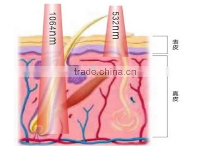 Medical CE approved yag laser machine / Nd yag laser / Q switch nd yag laser