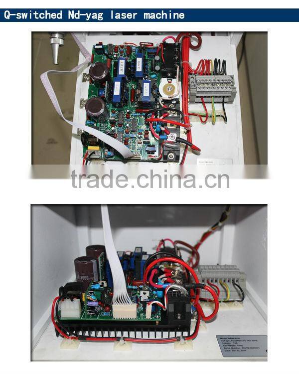 nd yag laser hair removal / tattoo removal laser equipment