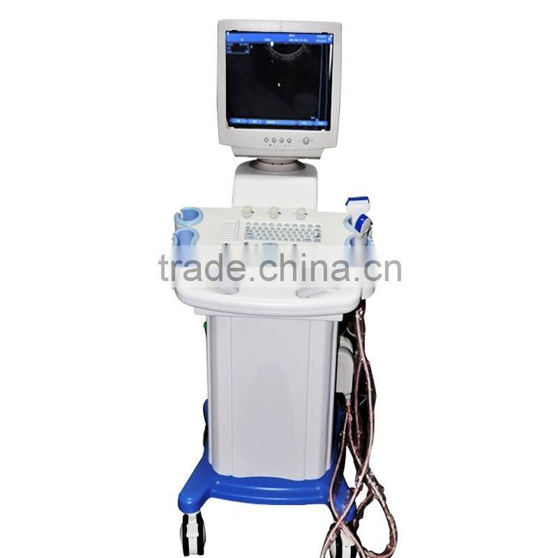 White+Bule wholesale Medical Supplier digital Ultrasound Machine for Pregnancy