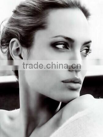 GTO brand 80 needles titanium derma stamp for acne mark removal