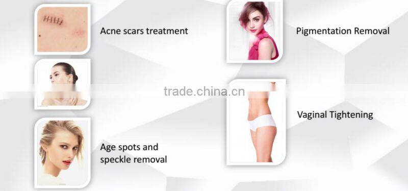 Co2 fractional laser machine popular co2 laser for vaginal tightening