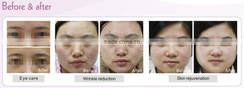 DEESS birthday gift Multifunctional Facial Care Microcurrent RF Wrinkle Reduction Tighten skin Machine