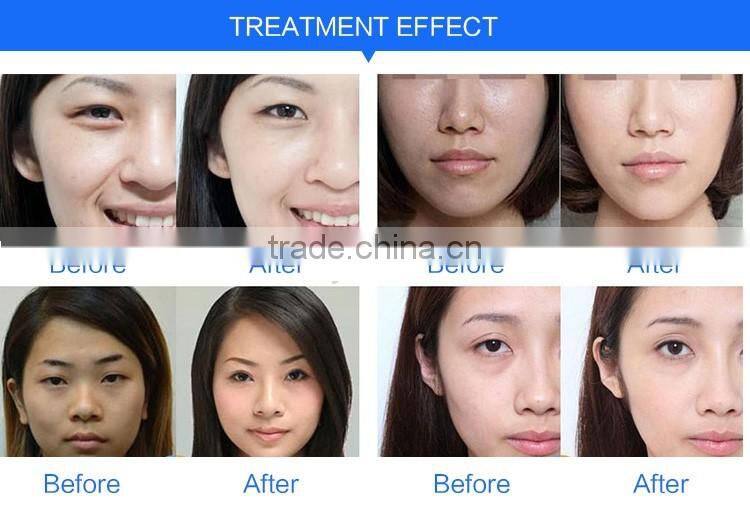 Hot sale titanium Needles 540 needles micro needle derma roller system derma roller