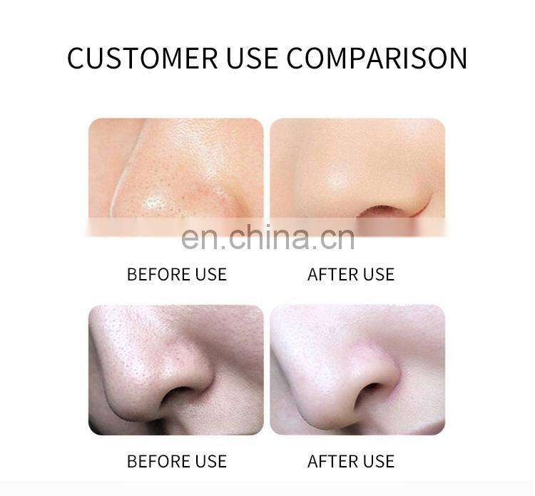 10 IN 1 Comprehensive Facial Massager Beauty Instrument Ion Bubble Cleansing Oxygen Hydration Rejuvenation Skin Care Machine