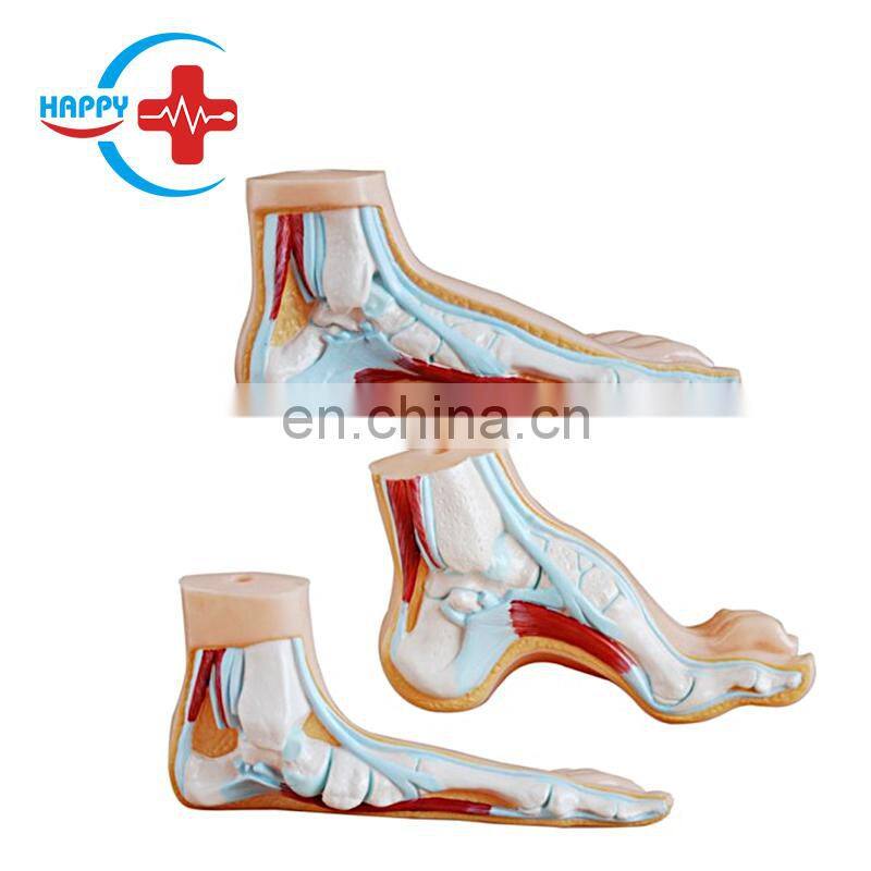 HC-S274 Normal foot/flat foot/arched foot model,Medical Human Anatomical foot model
