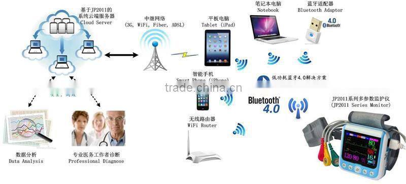 wrist ECG monitor