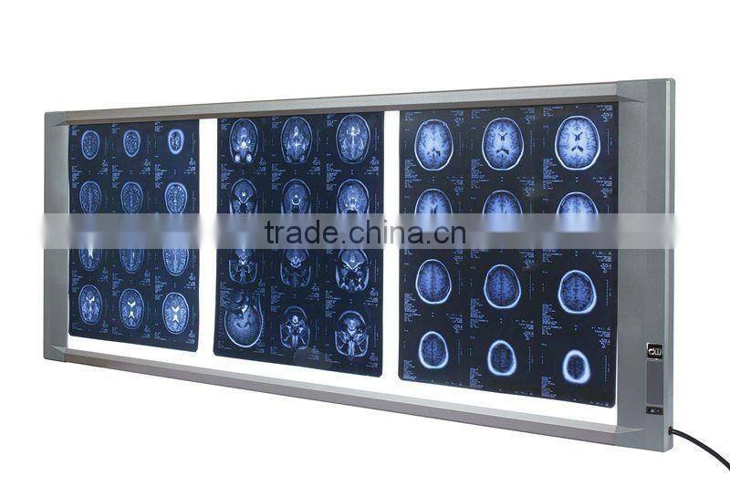 Digital x ray film reader